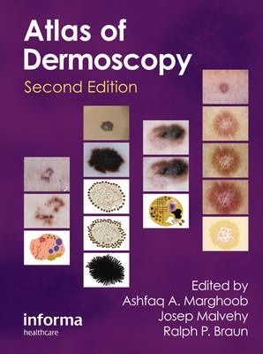 ATLAS OF DERMOSCOPY