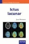 ICTUS LACUNAR