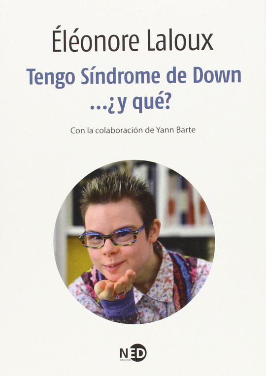TENGO S�NDROME DE DOWN...�Y QU�?
