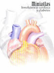 MINIATLAS INSUFICIENCIA CARDIACA Y DIABETES